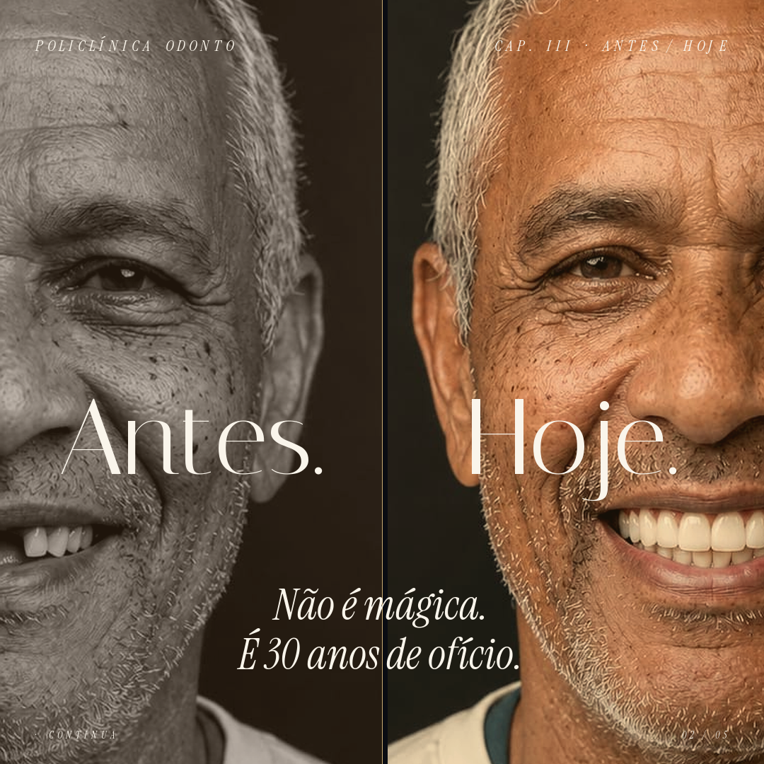 Depois 2